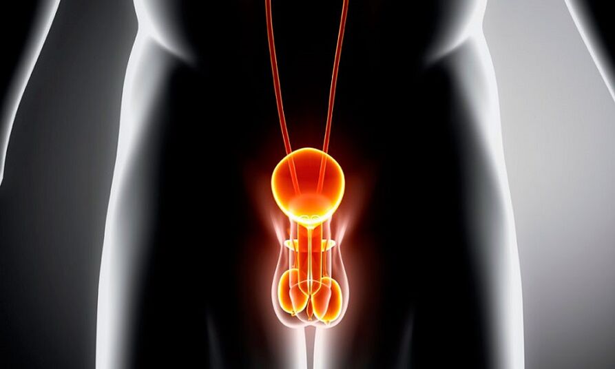 Système génito-urinaire enflammé pour la prostatite