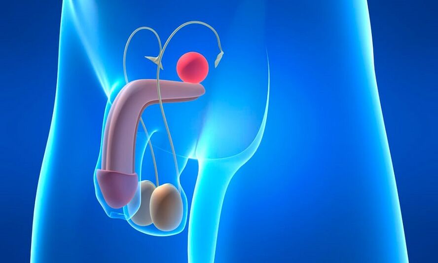 Œdème de la prostate avec prostatite